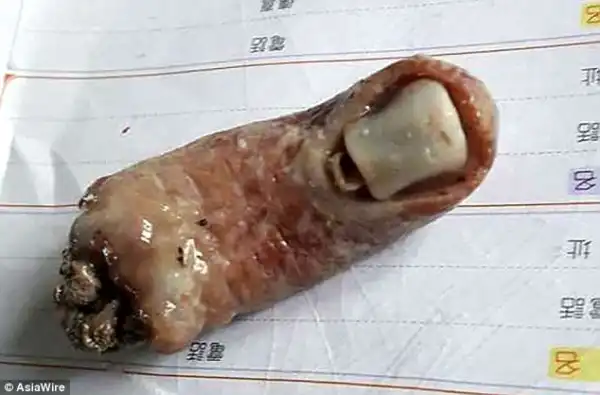 Would You Eat This? See What A Woman Found In Her Bowl Of Soup Photos